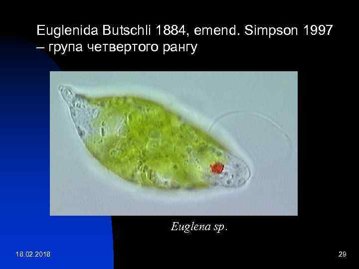 Euglenida Butschli 1884, emend. Simpson 1997 – група четвертого рангу Euglena sp. 18. 02.