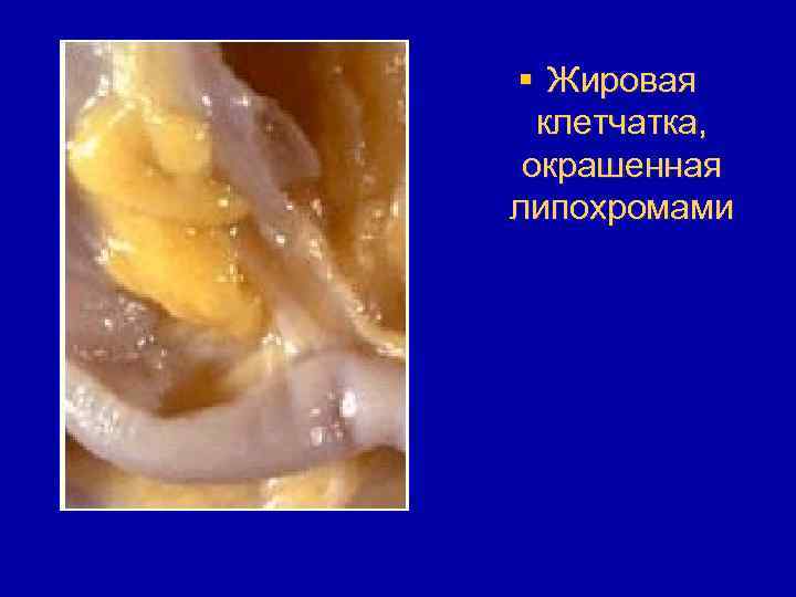 § Жировая клетчатка, окрашенная липохромами 