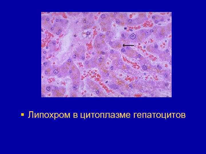§ Липохром в цитоплазме гепатоцитов 