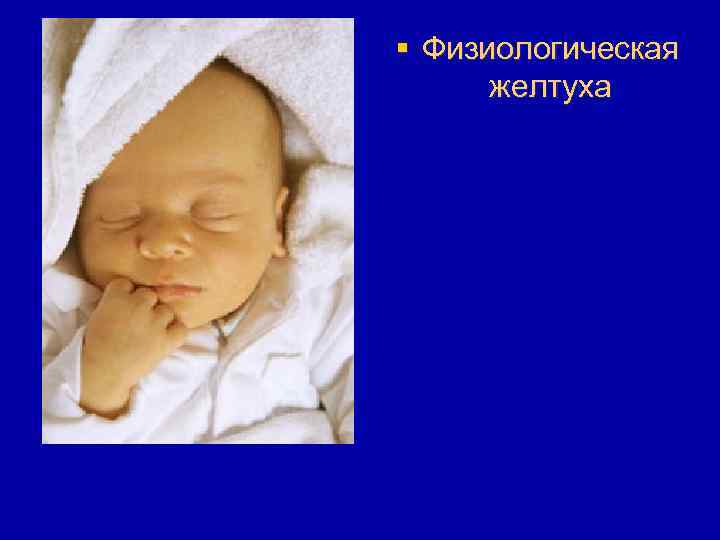 § Физиологическая желтуха 