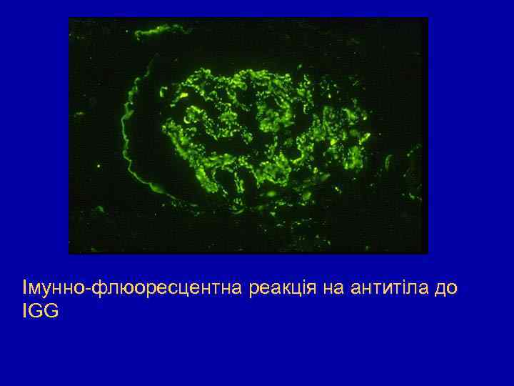 Імунно-флюоресцентна реакція на антитіла до IGG 