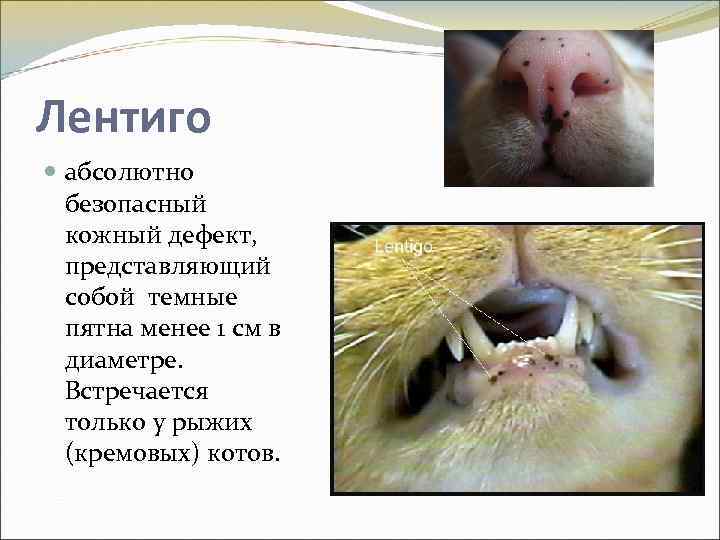 Лентиго абсолютно безопасный кожный дефект, представляющий собой темные пятна менее 1 см в диаметре.
