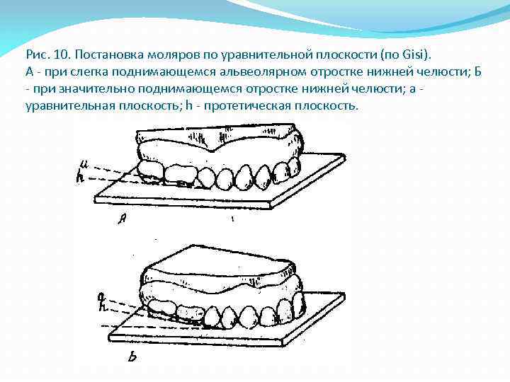 Постановка зубов по стеклу презентация