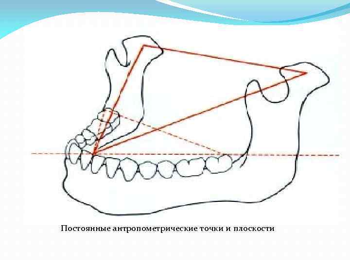 Окклюдаторы и артикуляторы презентация