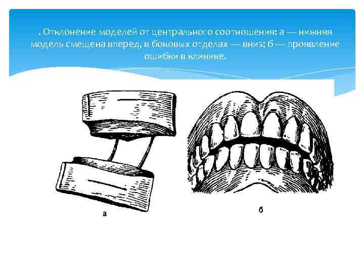 Презентация методы определения центрального соотношения челюстей