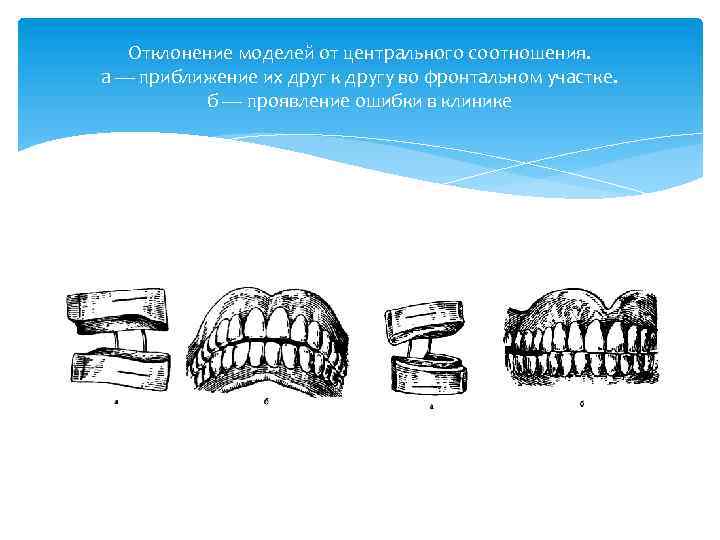 Отклонение моделей от центрального соотношения. а — приближение их друг к другу во фронтальном