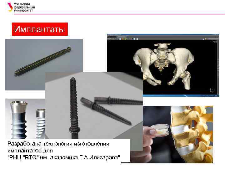 Имплантаты Разработана технология изготовления имплантатов для 