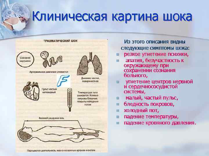 Клиническая картина кардиогенного шока