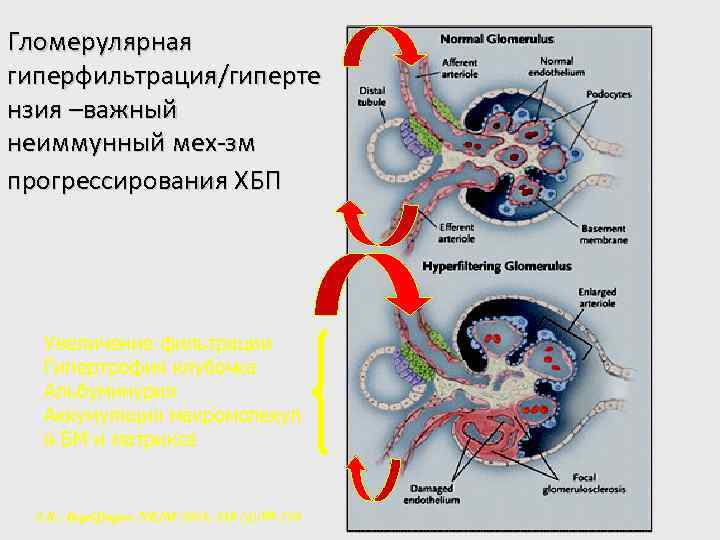 Гломерулярная гиперфильтрация/гиперте нзия –важный неиммунный мех-зм прогрессирования ХБП Увеличение фильтрации Гипертрофия клубочка Альбуминурия Аккумуляция