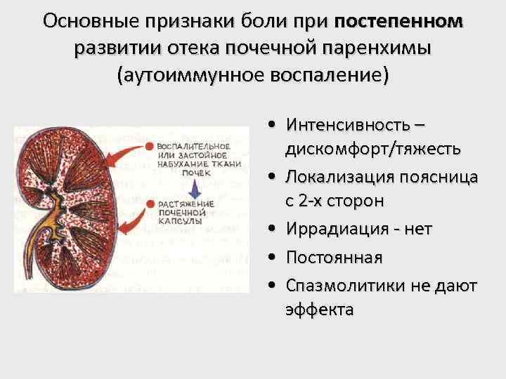 Основные признаки боли при постепенном развитии отека почечной паренхимы (аутоиммунное воспаление) • Интенсивность –