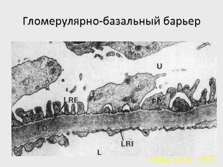 Гломерулярно-базальный барьер Chrug J et al. , 1995 