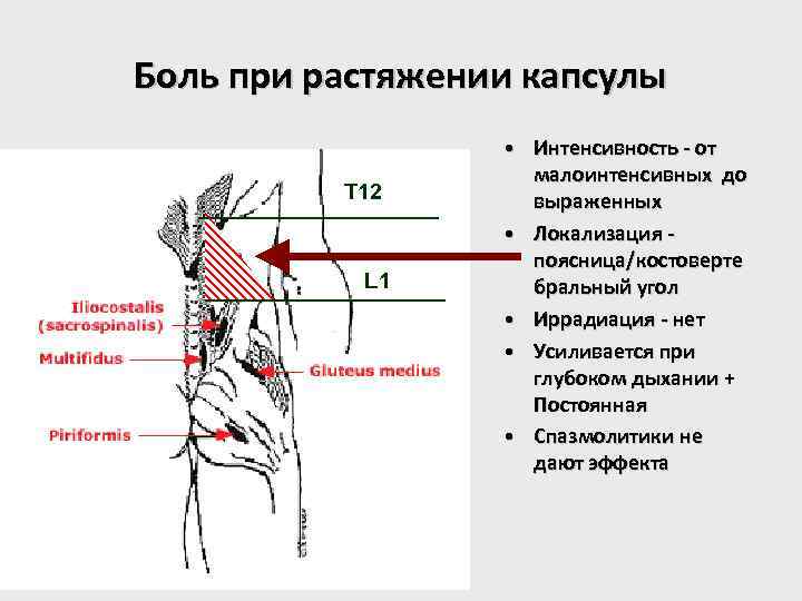 Боль при растяжении капсулы T 12 L 1 • Интенсивность - от малоинтенсивных до