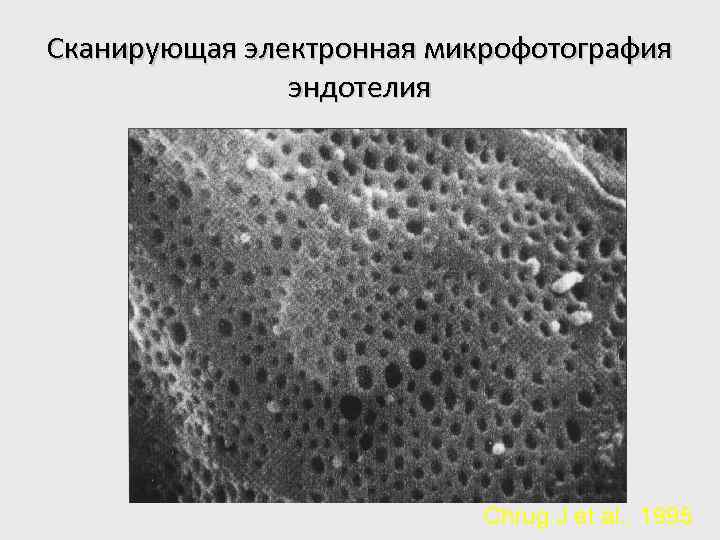 Сканирующая электронная микрофотография эндотелия Chrug J et al. , 1995 