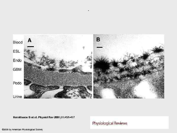 . Haraldsson B et al. Physiol Rev 2008; 88: 451 -487 © 2008 by