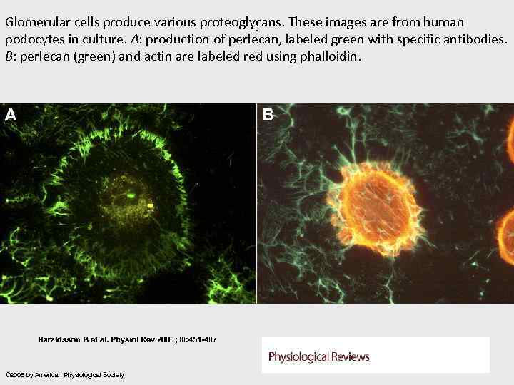 Glomerular cells produce various proteoglycans. These images are from human. podocytes in culture. A: