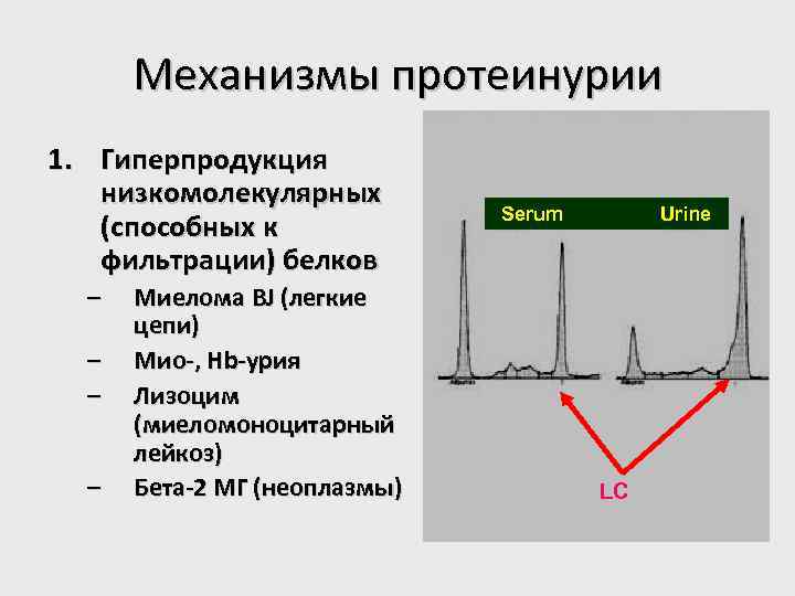 Механизмы протеинурии 1. Гиперпродукция низкомолекулярных (способных к фильтрации) белков – – Миелома BJ (легкие