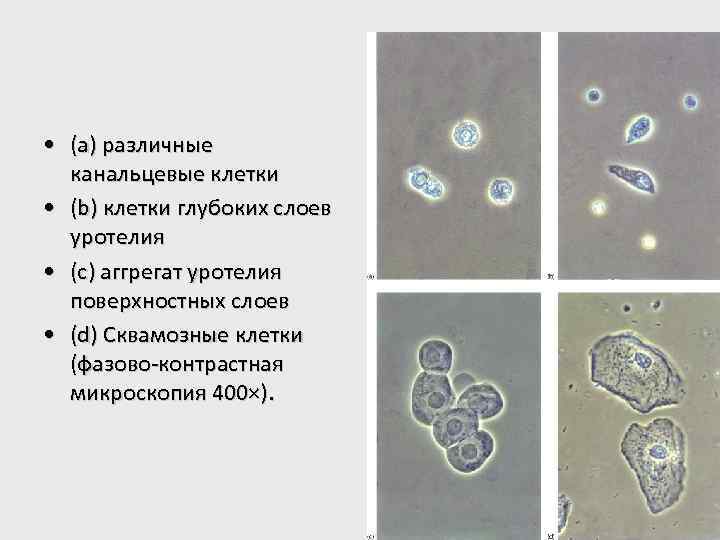  • (a) различные канальцевые клетки • (b) клетки глубоких слоев уротелия • (c)