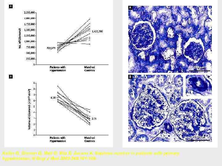 Keller G, Zimmer G, Mall G, Ritz E, Amann K. Nephron number in patients