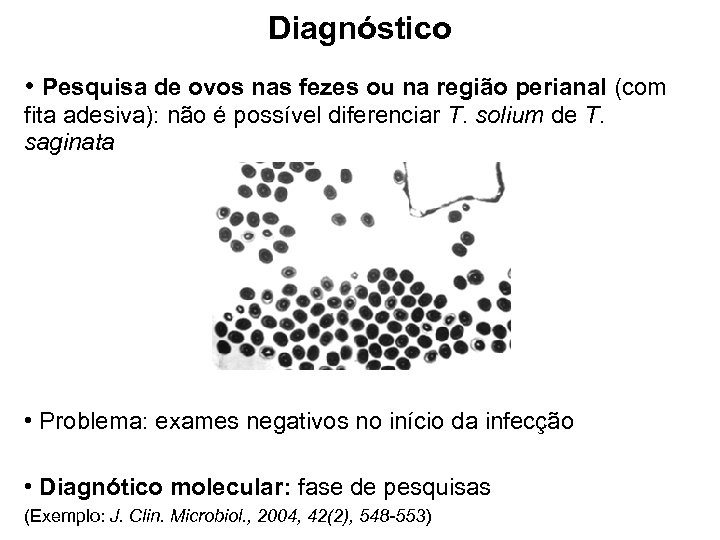 Diagnóstico • Pesquisa de ovos nas fezes ou na região perianal (com fita adesiva):