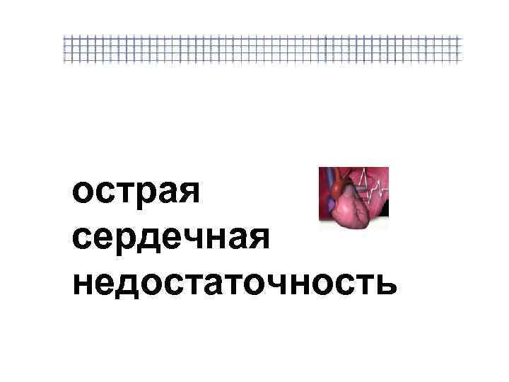 острая сердечная недостаточность 