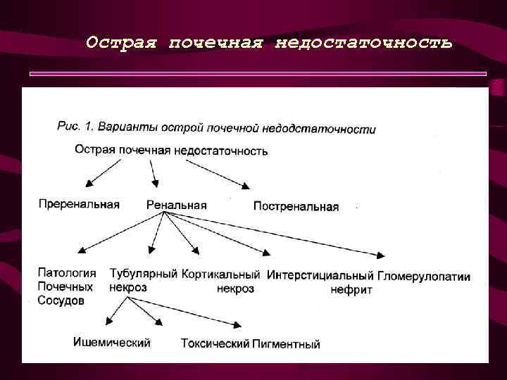 Острая почечная недостаточность 