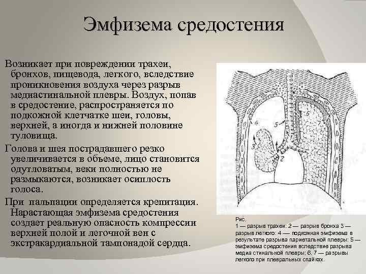 Эмфизема средостения Возникает при повреждении трахеи, бронхов, пищевода, легкого, вследствие проникновения воздуха через разрыв