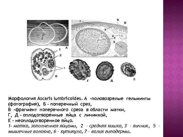 Морфология Ascaris lumbricoides. А -половозрелые гельминты (фотография), Б – поперечный срез, В -фрагмент поперечного