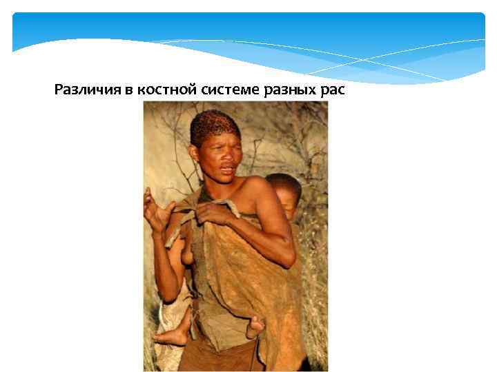 Различия в костной системе разных рас 