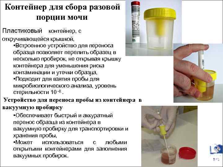 Контейнер для сбора разовой порции мочи Пластиковый контейнер, с откручивающейся крышкой, • Встроенное устройство