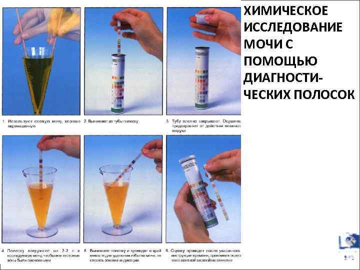 ХИМИЧЕСКОЕ ИССЛЕДОВАНИЕ МОЧИ С ПОМОЩЬЮ ДИАГНОСТИЧЕСКИХ ПОЛОСОК 