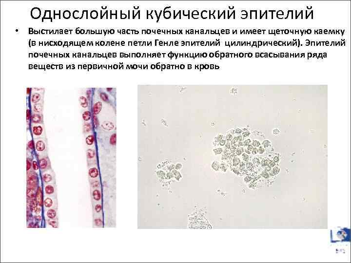 Почечный эпителий фото