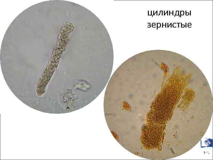 цилиндры зернистые 