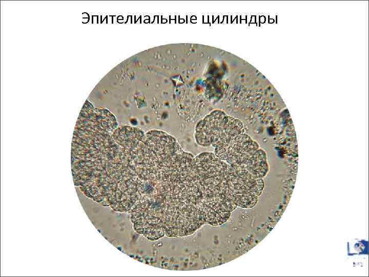 Эпителиальные цилиндры 
