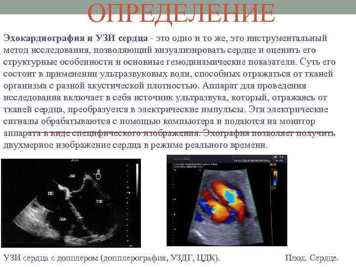 ОПРЕДЕЛЕНИЕ Эхокардиография и УЗИ сердца - это одно и то же, это инструментальный метод