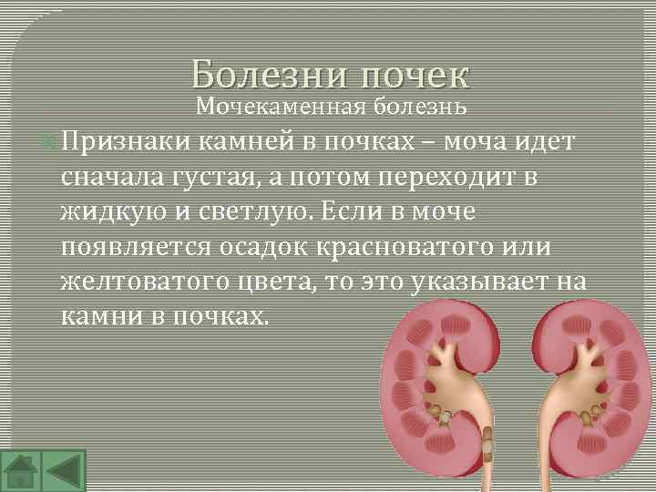 Болезни почек Мочекаменная болезнь Признаки камней в почках – моча идет сначала густая, а