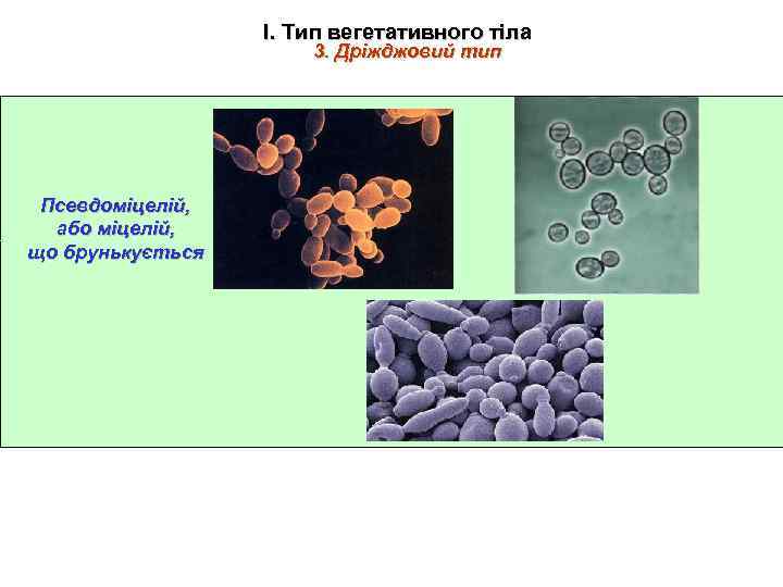 І. Тип вегетативного тіла 3. Дріжджовий тип Псевдоміцелій, або міцелій, що брунькується 
