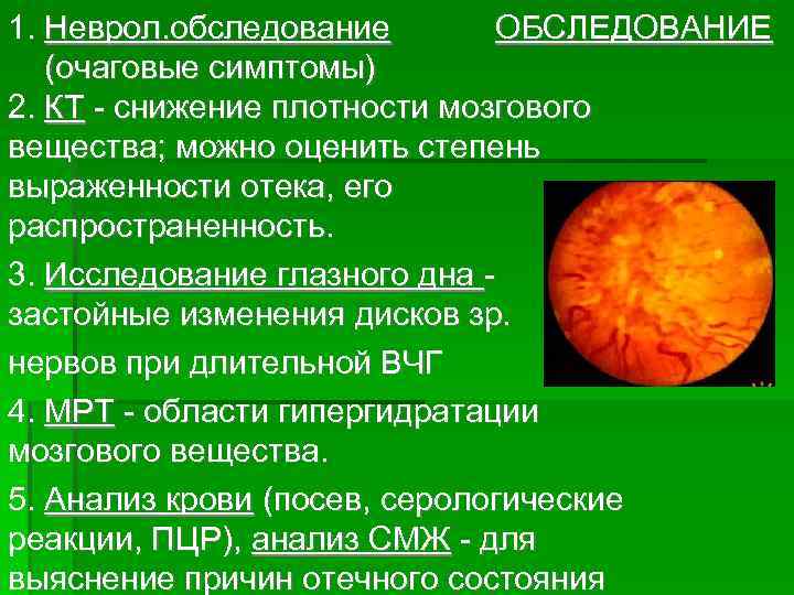 ОБСЛЕДОВАНИЕ 1. Неврол. обследование (очаговые симптомы) 2. КТ - снижение плотности мозгового вещества; можно