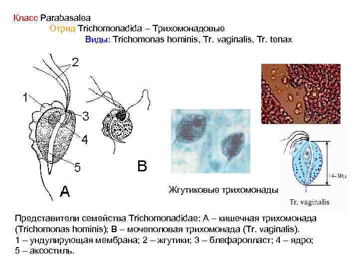 Трихомонада кишечная. Трихомонады Тип класс отряд. Trichomonas Hominis представители. Урогенитальная трихомонада Тип класс.