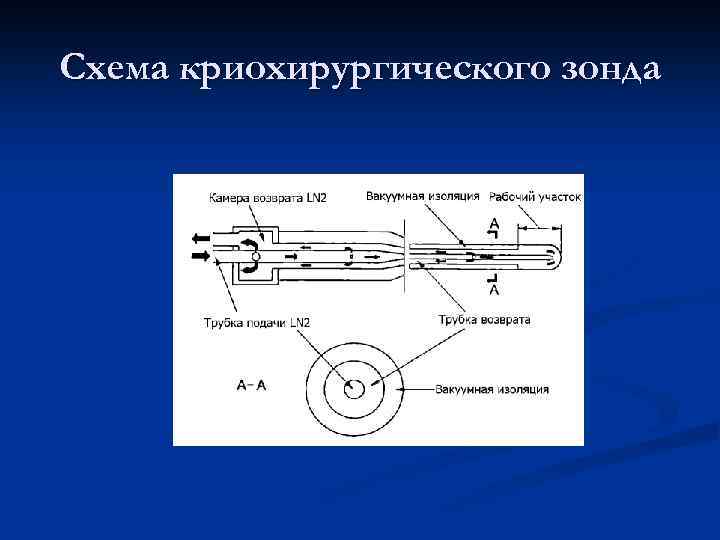 Схема криохирургического зонда 
