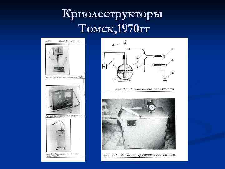 Криодеструкторы Томск, 1970 гг 
