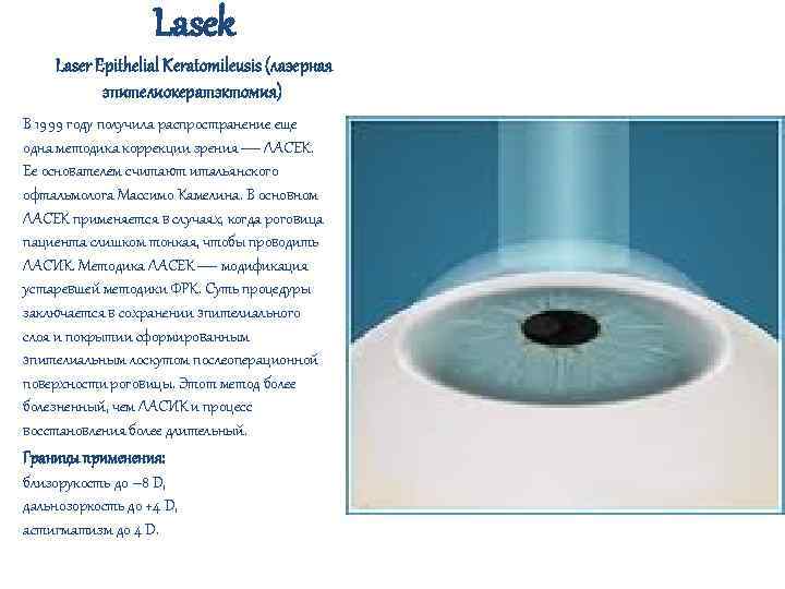 Lasek Laser Epithelial Keratomileusis (лазерная эпителиокератэктомия) В 1999 году получила распространение еще одна методика