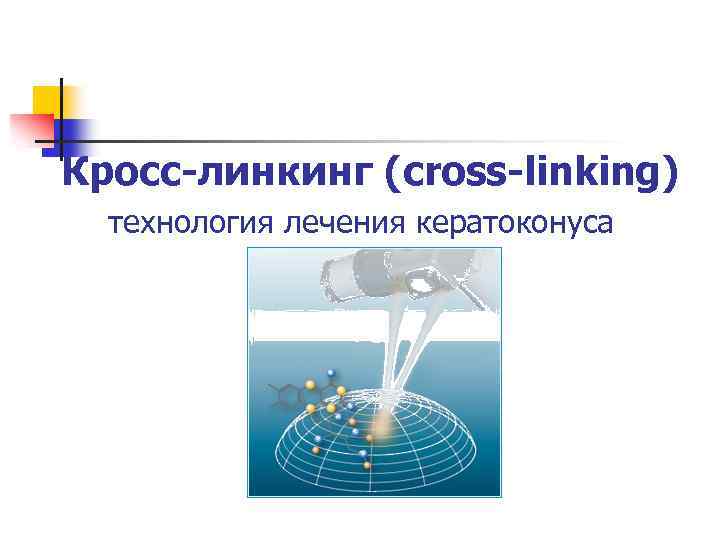 Кросс-линкинг (cross-linking) технология лечения кератоконуса 