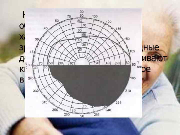 Клиновидные выпадения объясняются секторальным характером кровоснабжения зрительного нерва. Клиновидные дефекты, сливаясь, обусловливают квадрантное или