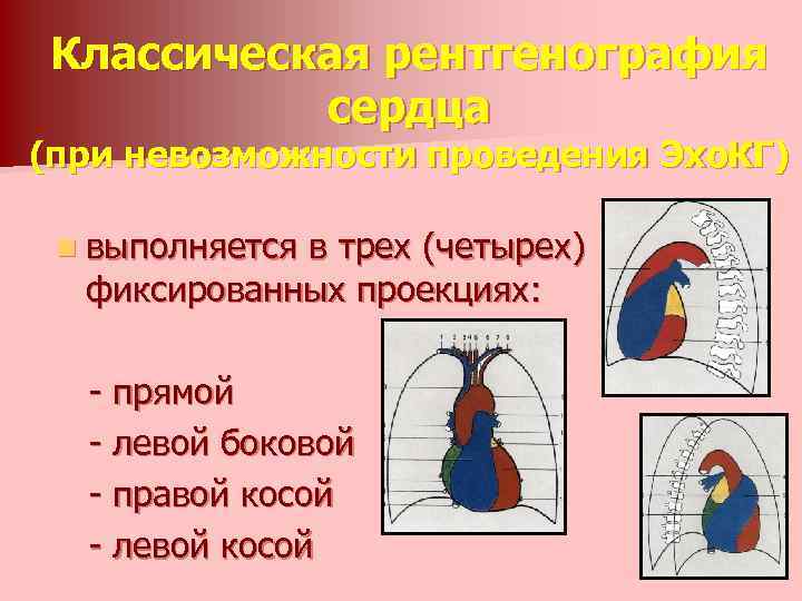 Классическая рентгенография сердца (при невозможности проведения Эхо. КГ) n выполняется в трех (четырех) фиксированных