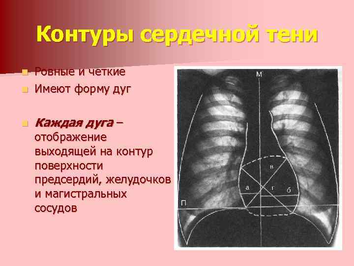 Контуры сердечной тени Ровные и четкие n Имеют форму дуг n n Каждая дуга