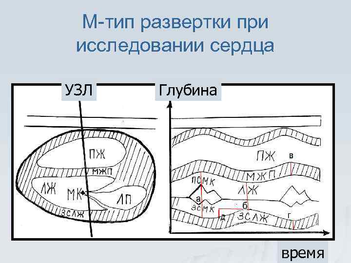 М-тип развертки при исследовании сердца УЗЛ Глубина время 