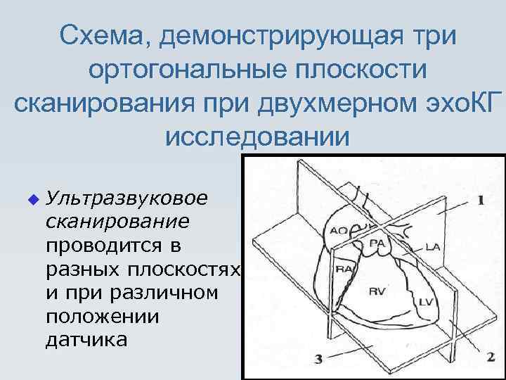 Принципы получения ультразвукового изображения сердца в трех режимах сканирования