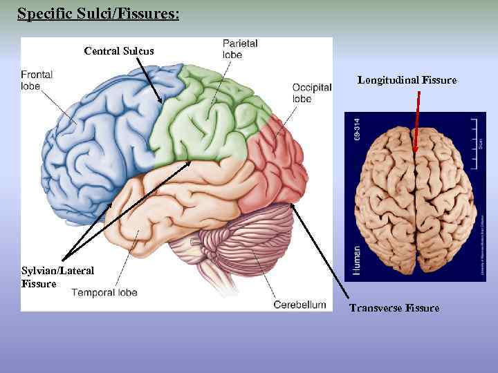 Specific Sulci/Fissures: Central Sulcus Longitudinal Fissure Sylvian/Lateral Fissure Transverse Fissure 