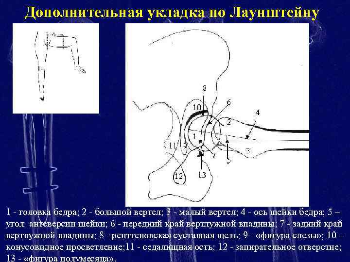 На рисунках представлены рентгенограммы суставов человека какой цифрой отмечена рентгенограмма