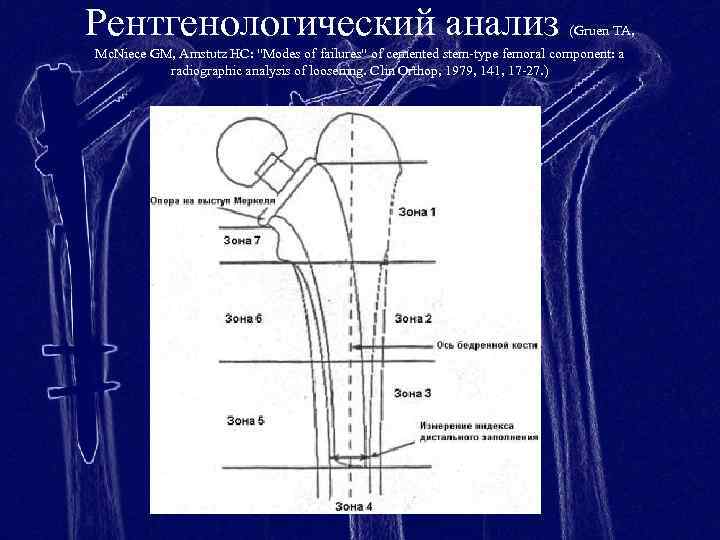 Проксимальный отдел бедренной кости где находится фото